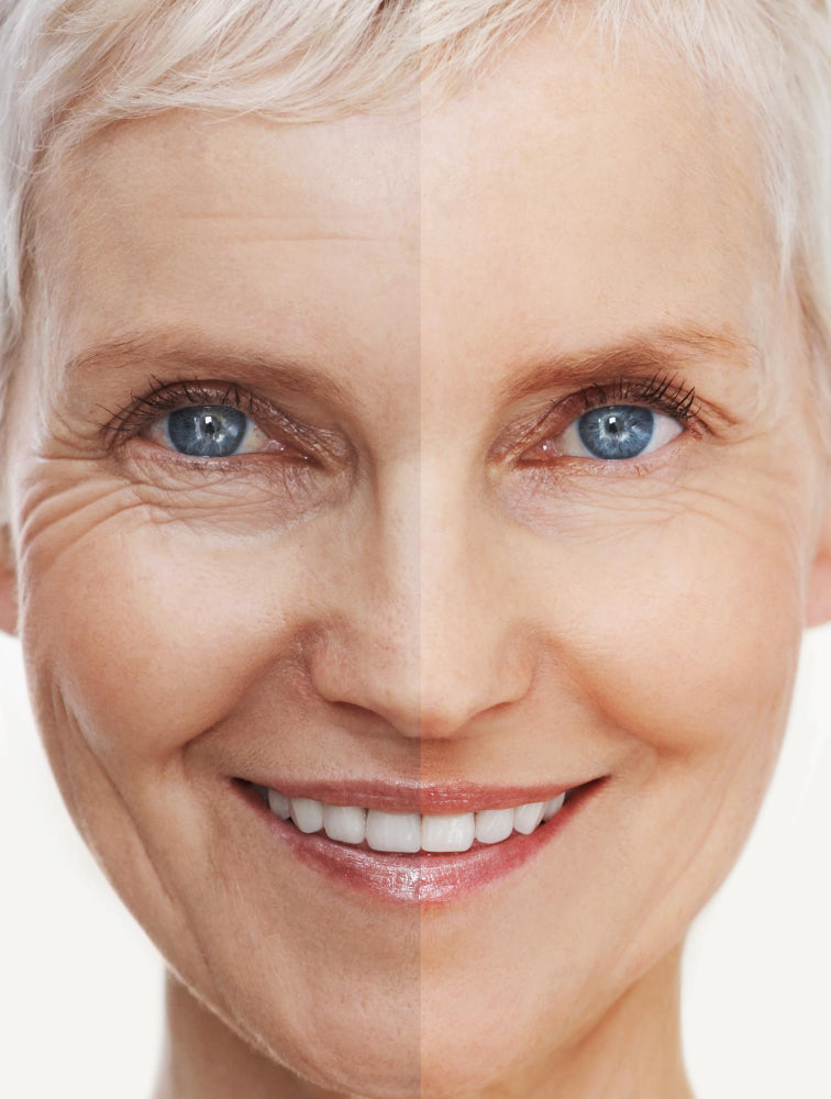 The image depicts an elderly woman’s face with a before-and-after effect. One half shows wrinkles and signs of aging, while the other side appears smoother and more youthful, highlighting the potential benefits of anti-aging skincare or treatments.